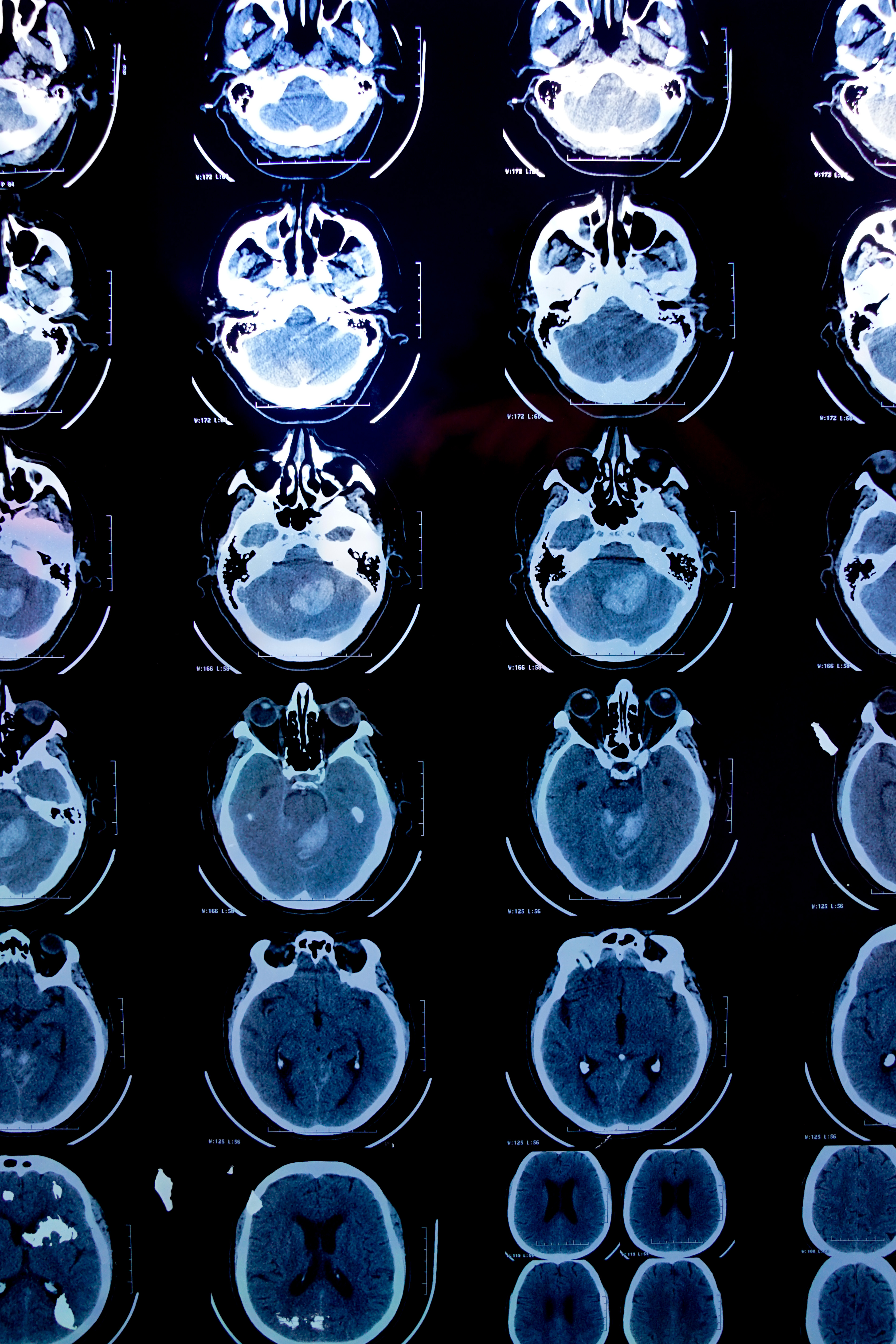 Radiologische Bildgebung